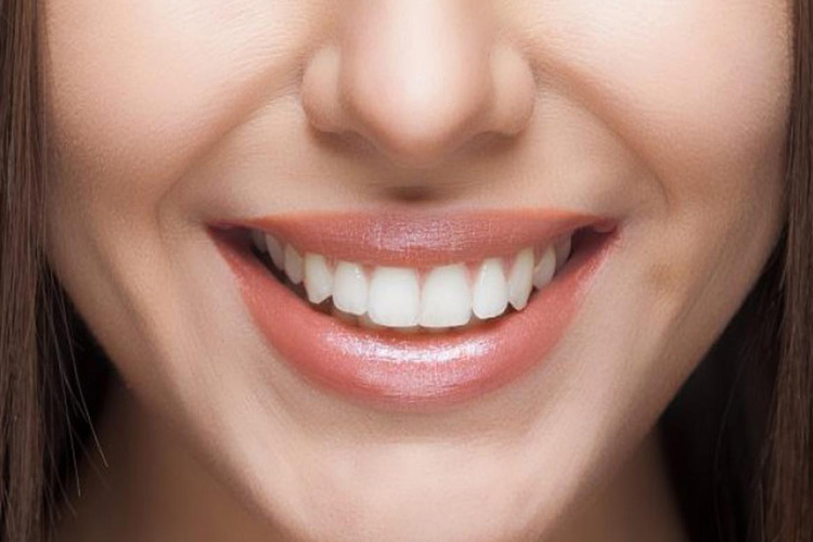 Hollywood Gülüşü